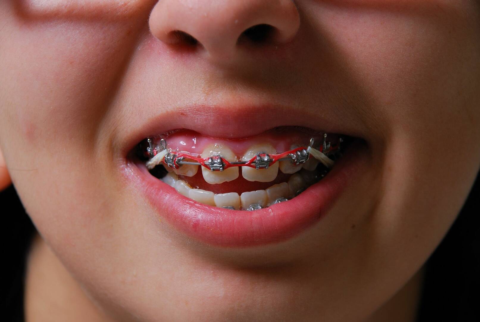 Family Orthodontist Highland Park IL